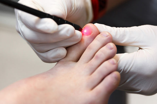 Laser Therapy
